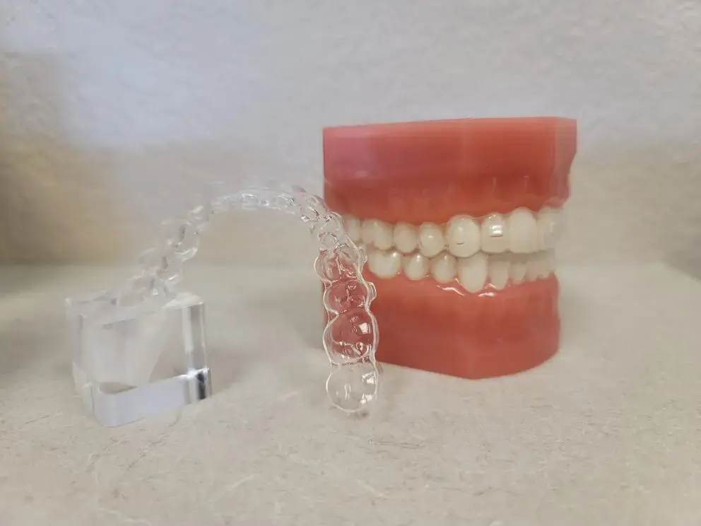 On a light surface, a dental aligner model sits by a clear aligner and stand at Natalie Yang Orthodontics Orthodontics in Vacaville, CA.