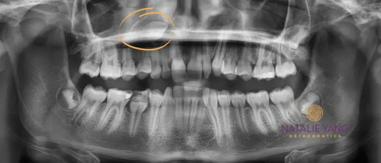 Natalie Yang Orthodontics
