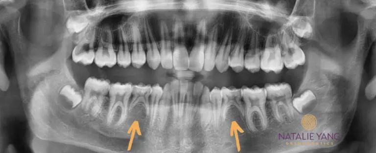 Natalie Yang Orthodontics