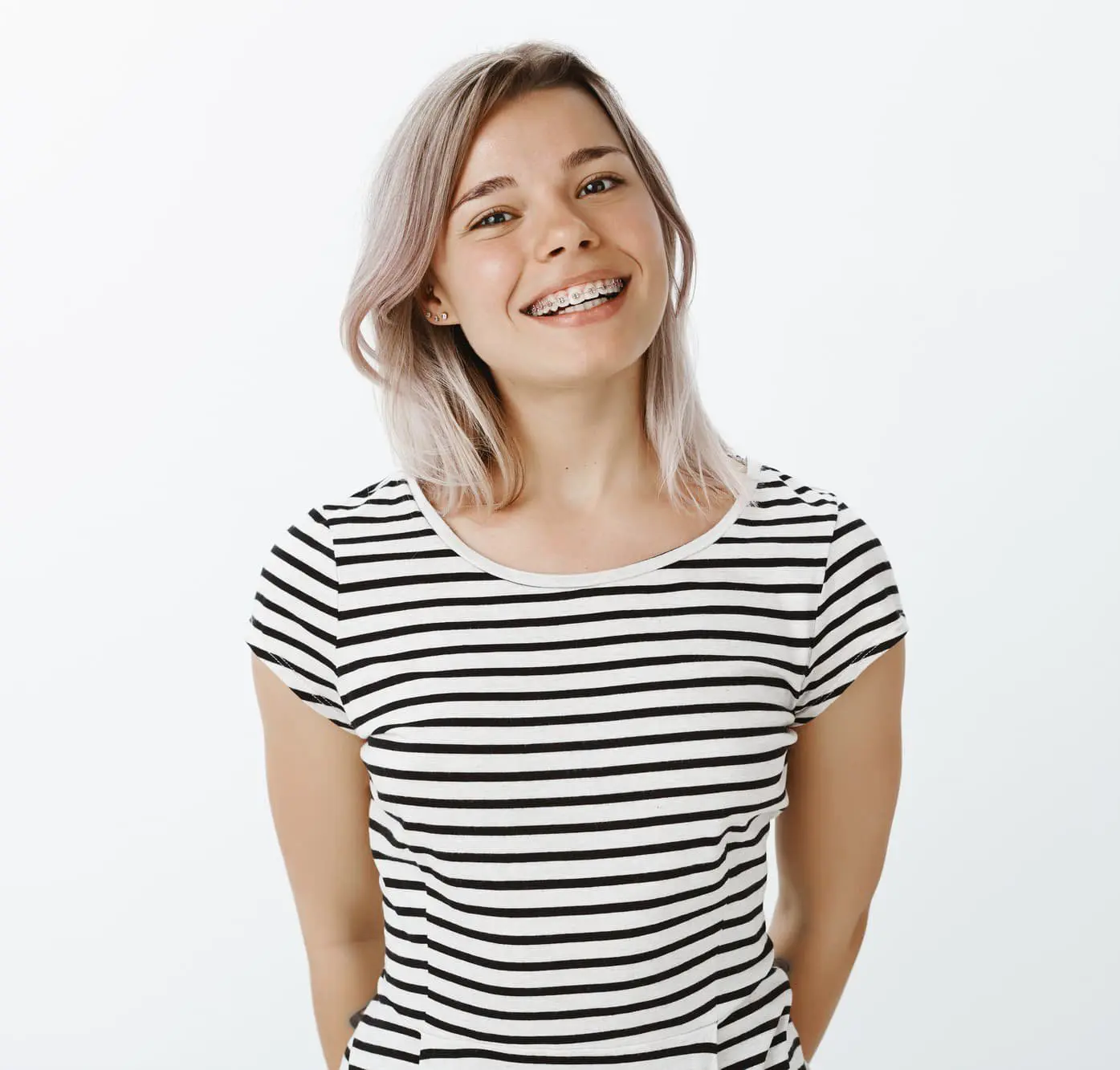 Young woman with light hair wearing a black and white striped t-shirt, smiling and showing braces learning about affordable braces cost solutions at Natalie Yang Orthodontics in Vacaville, CA.