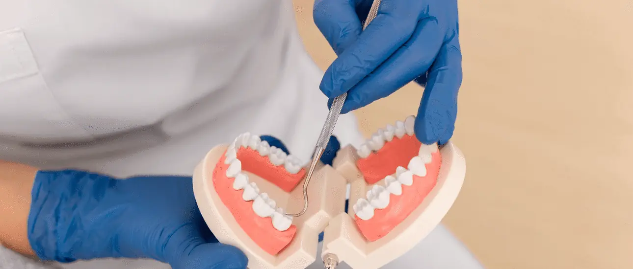 At Natalie Yang Orthodontics Orthodontics in Vacaville, CA, a professional in blue gloves uses a dental tool to demonstrate an overbite on a model of human teeth and gums. At Natalie Yang Orthodontics Orthodontics in Vacaville, CA, a professional in blue gloves uses a dental tool to demonstrate an overbite on a model of human teeth and gums.