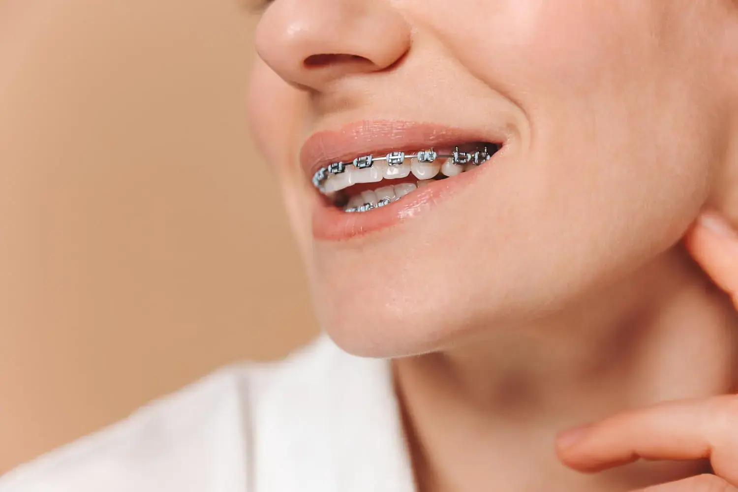 A close-up shows a light-skinned person smiling and touching their face, highlighting metal braces used to correct an overbite—available at Natalie Yang Orthodontics Orthodontics in Vacaville, CA. A close-up shows a light-skinned person smiling and touching their face, highlighting metal braces used to correct an overbite—available at Natalie Yang Orthodontics Orthodontics in Vacaville, CA.