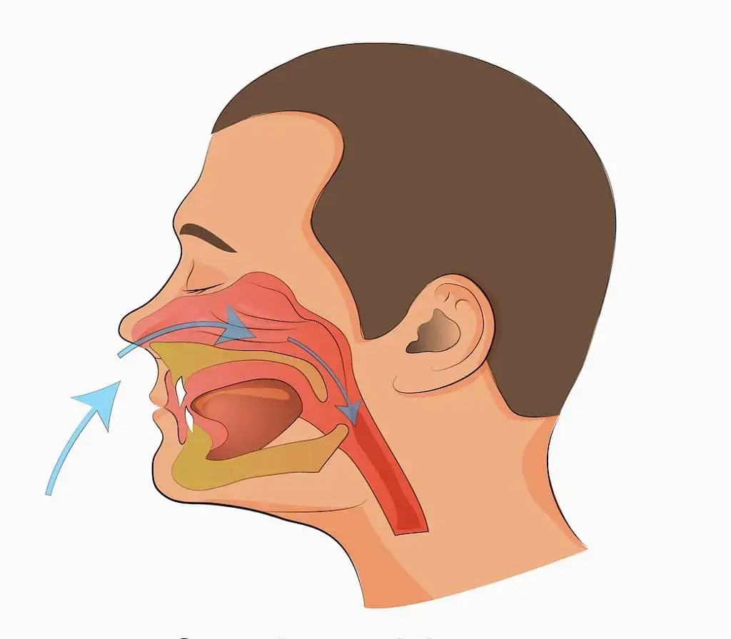 At Natalie Yang Orthodontics Orthodontics in Vacaville, CA, a side profile illustration of a human head demonstrates the airflow path of a mouth breather, highlighting air movement through the nasal cavity, mouth, throat, and airway during breathing. At Natalie Yang Orthodontics Orthodontics in Vacaville, CA, a side profile illustration of a human head demonstrates the airflow path of a mouth breather, highlighting air movement through the nasal cavity, mouth, throat, and airway during breathing.