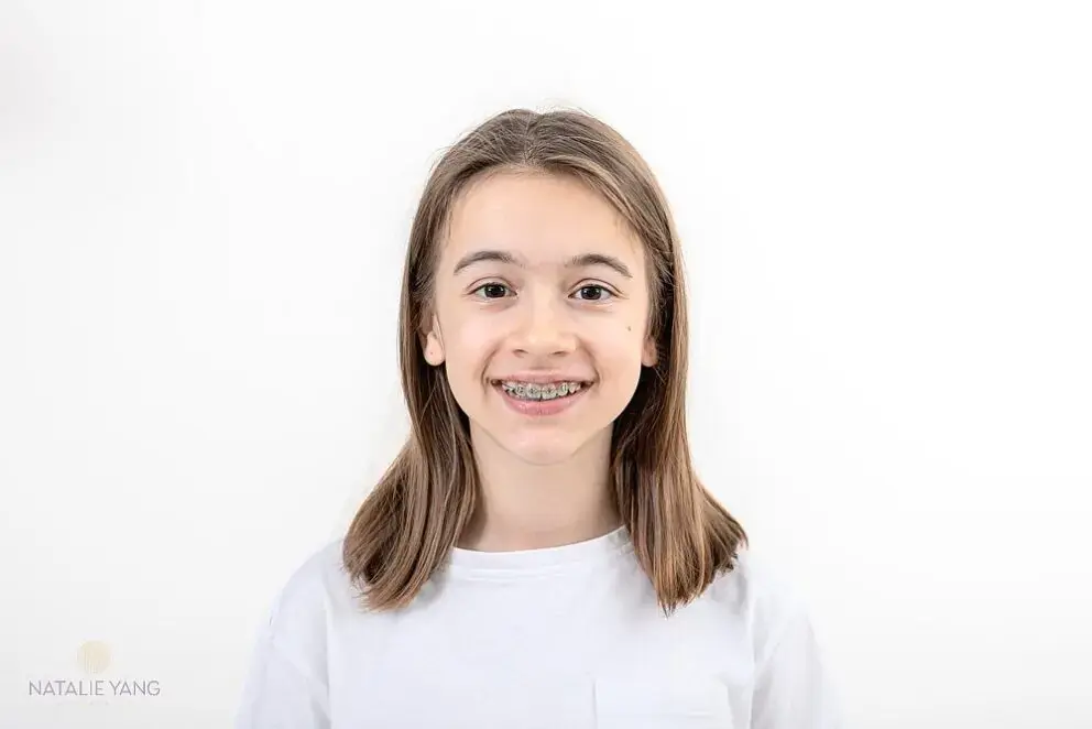 Natalie Yang Orthodontics – Vacaville Orthodontist Natalie Yang Orthodontics – Vacaville Orthodontist