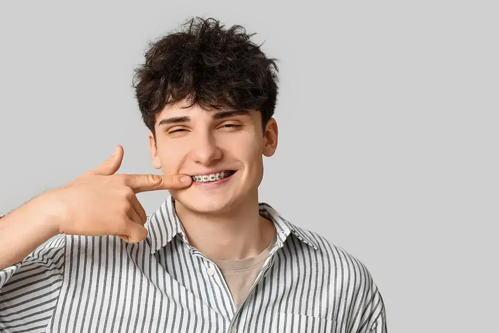 A young man in a striped shirt smiles and points at his adult braces, promoting Natalie Yang Orthodontics Orthodontics in Vacaville, CA. A young man in a striped shirt smiles and points at his adult braces, promoting Natalie Yang Orthodontics Orthodontics in Vacaville, CA.