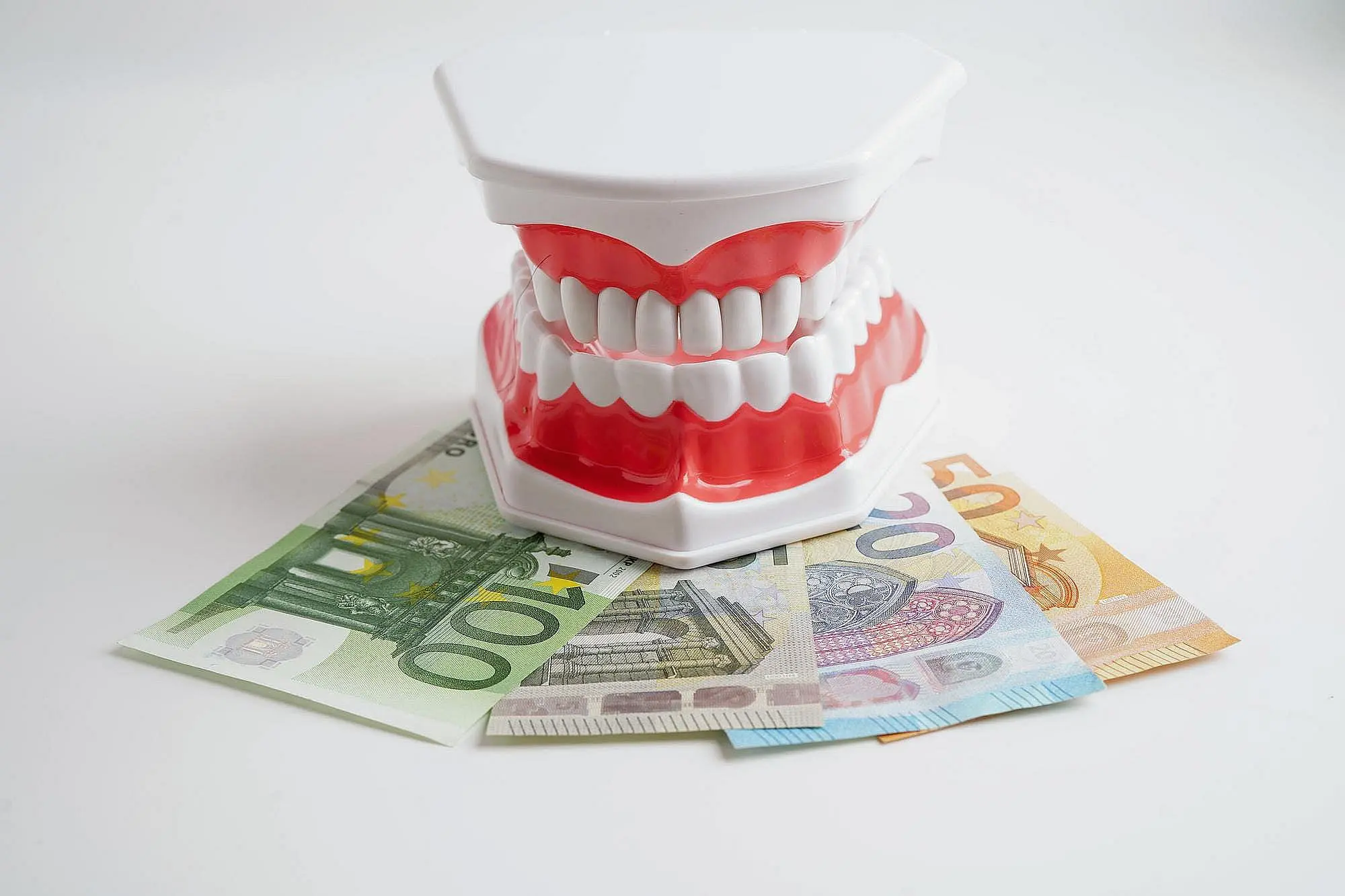 On a white surface, a model of human teeth sits atop fanned euro banknotes representing metal braces cost at Natalie Yang Orthodontics in Vacaville, CA.