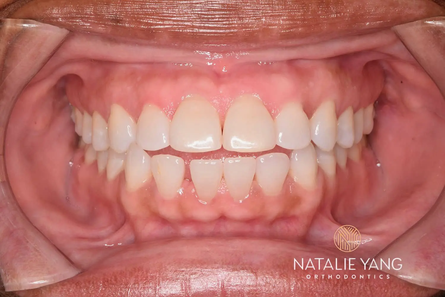 Natalie Yang Orthodontics – Vacaville Orthodontist Natalie Yang Orthodontics – Vacaville Orthodontist